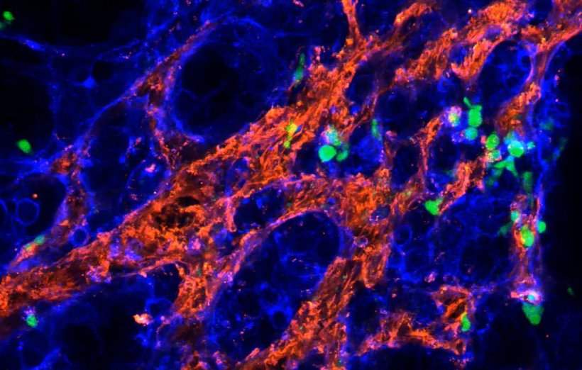 Fluoreszenzmikroskopische Aufnahme von Gamma-Delta-T-Zellen (grün), die...