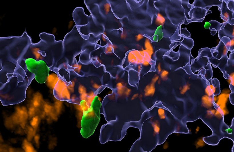 Mikroskopische Aufnahme von T-Helferzellen (grün) und Fresszellen (orange),...