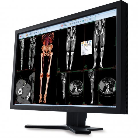 monitor showing medical images