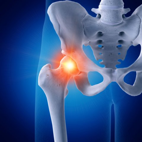 3d rendered illustration of a painful hip joint