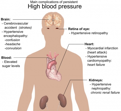 Main complications of high blood pressure