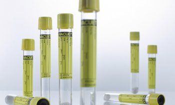Vacuette Urine CCM Tube