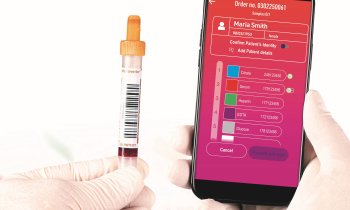 Digitising Pre-Analytics with S4DX System